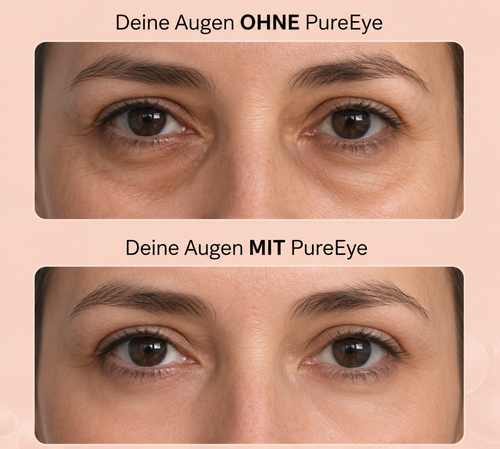 PureEye® 2-in-1 Rot Licht Therapie